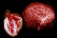 cerebro-corazon